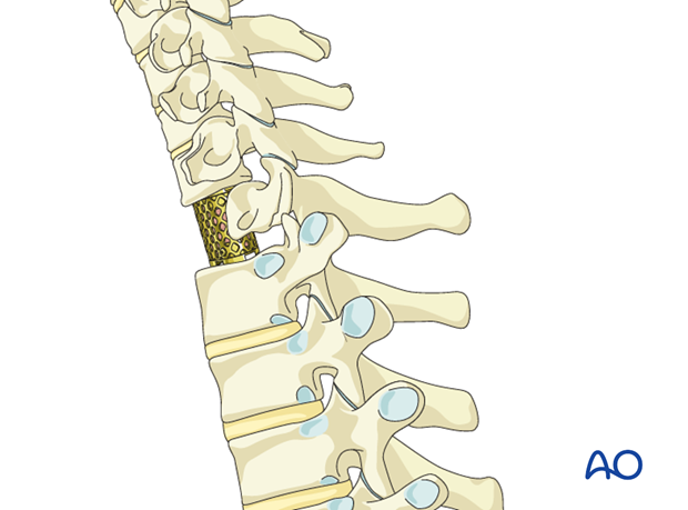 postoperative deformities