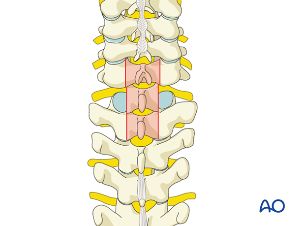 postoperative deformities