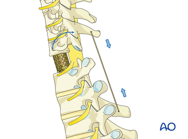 postoperative deformities