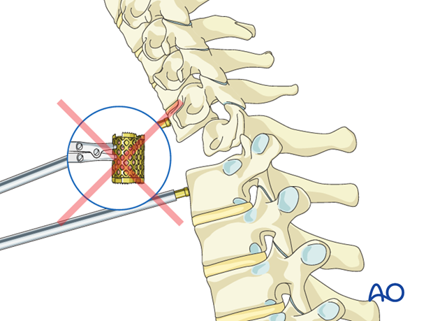 postoperative deformities