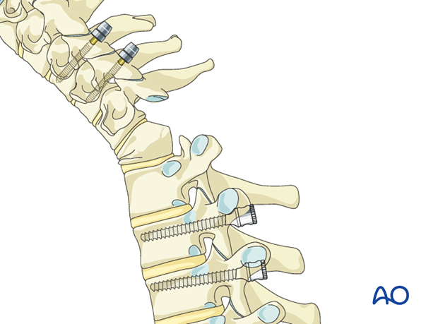 postoperative deformities