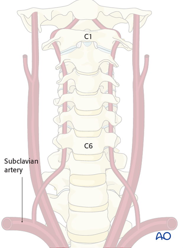 surgical compliations