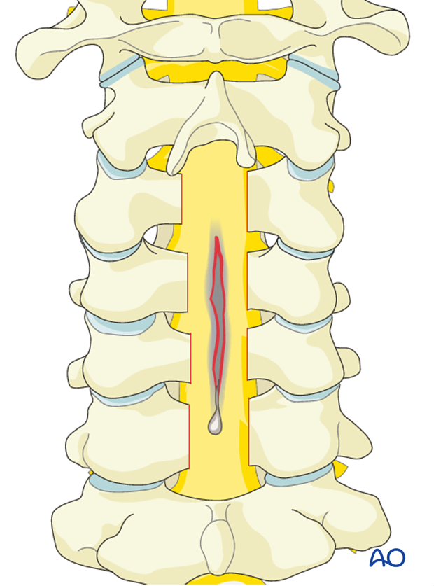 surgical compliations