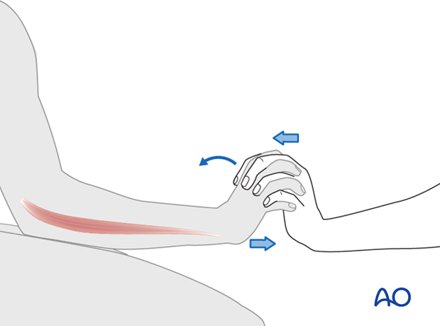 Thoracic and lumbar fractures: Patient examination - neurological evaluation