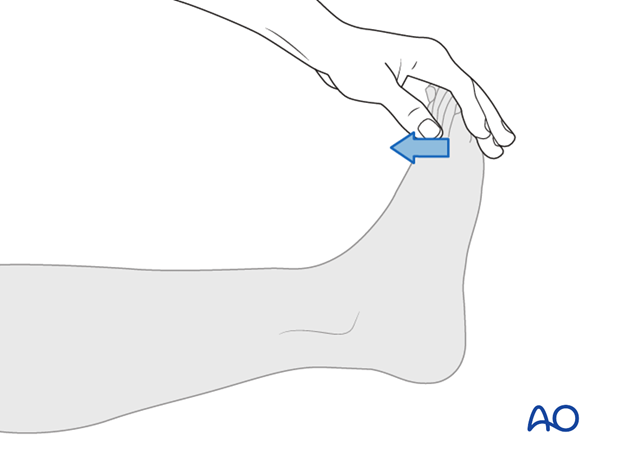 Thoracic and lumbar fractures: Patient examination - neurological evaluation