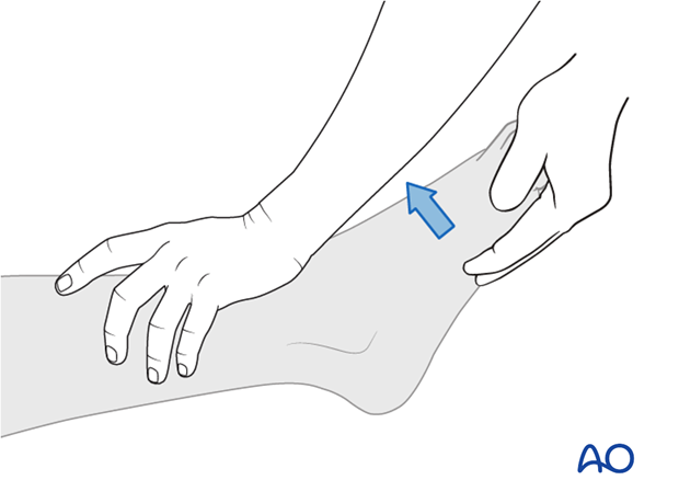 Thoracic and lumbar fractures: Patient examination - neurological evaluation