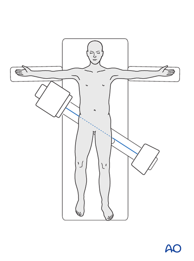 Patient Examination: Radiological evaluation (XR,CT, MRI)