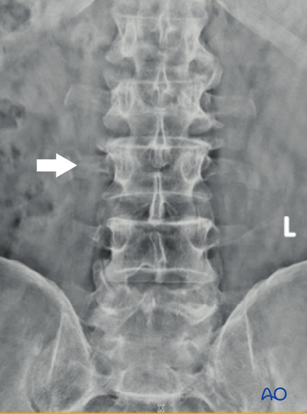 Patient Examination: Radiological evaluation (XR,CT, MRI)