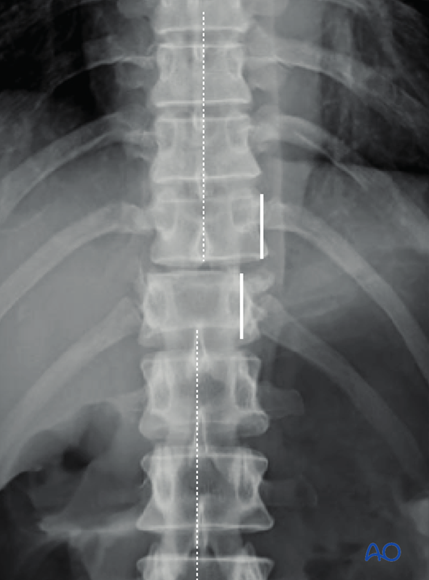 Patient Examination: Radiological evaluation (XR,CT, MRI)