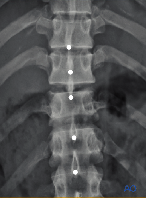 Patient Examination: Radiological evaluation (XR,CT, MRI)