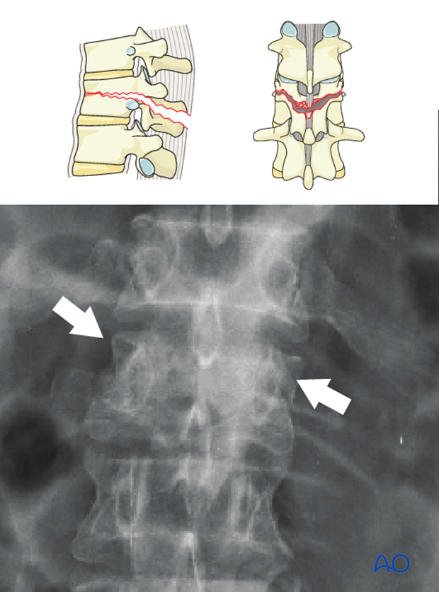 Patient Examination: Radiological evaluation (XR,CT, MRI)