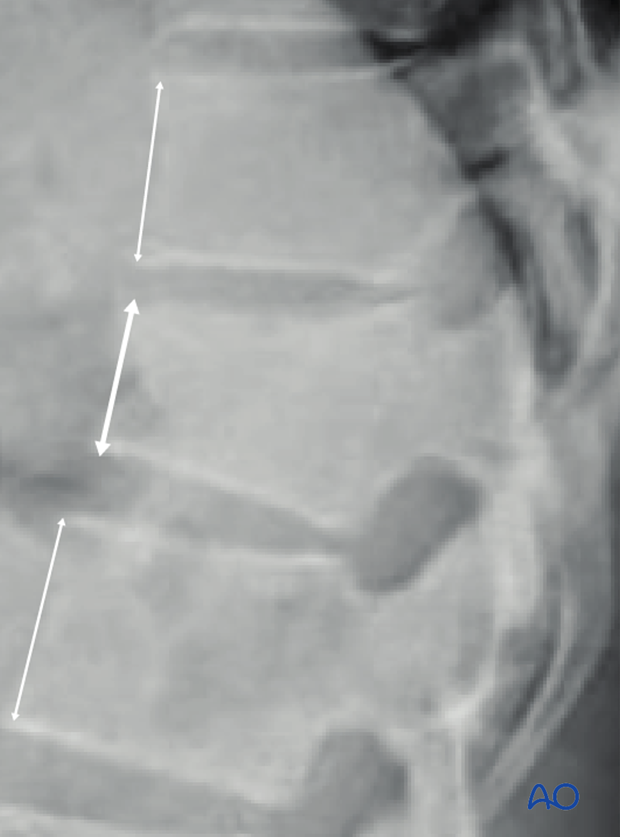 Patient Examination: Radiological evaluation (XR,CT, MRI)