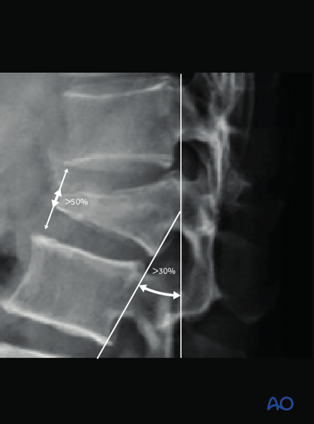 Patient Examination: Radiological evaluation (XR,CT, MRI)