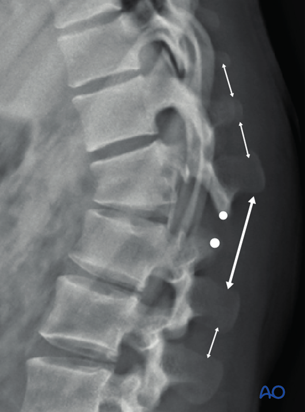 Patient Examination: Radiological evaluation (XR,CT, MRI)