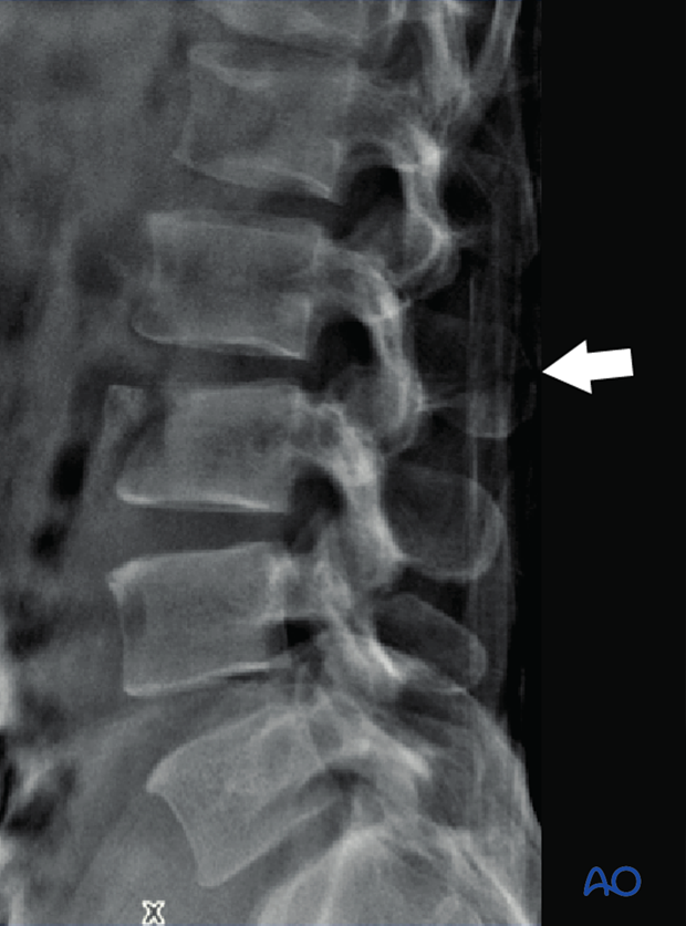 Patient Examination: Radiological evaluation (XR,CT, MRI)