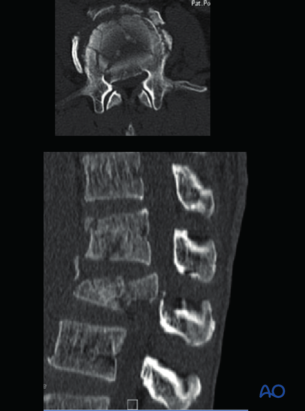 Patient Examination: Radiological evaluation (XR,CT, MRI)