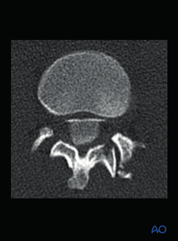 Patient Examination: Radiological evaluation (XR,CT, MRI)