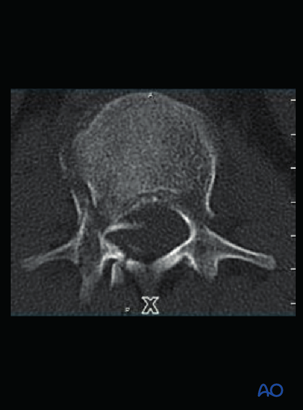 Patient Examination: Radiological evaluation (XR,CT, MRI)