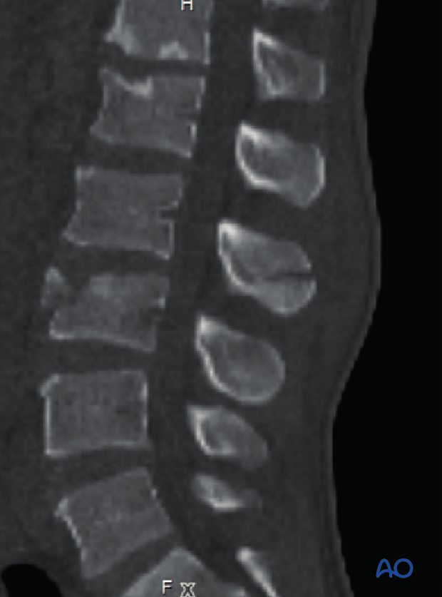 Patient Examination: Radiological evaluation (XR,CT, MRI)