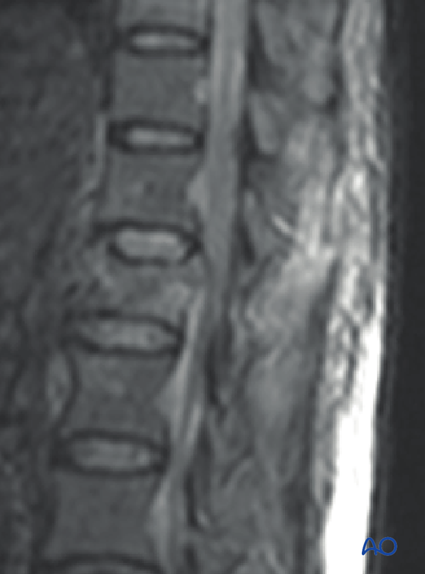 Patient Examination: Radiological evaluation (XR,CT, MRI)