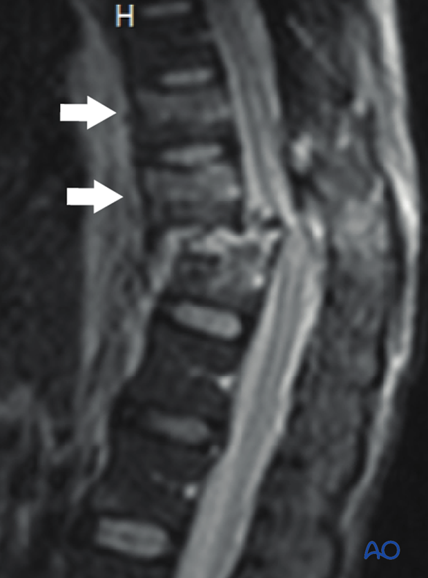 Patient Examination: Radiological evaluation (XR,CT, MRI)