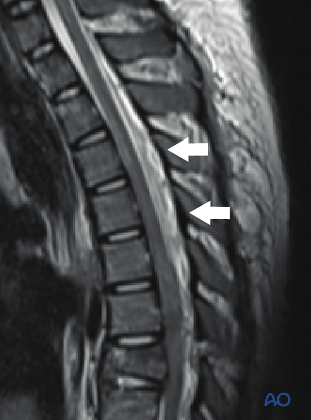 Patient Examination: Radiological evaluation (XR,CT, MRI)