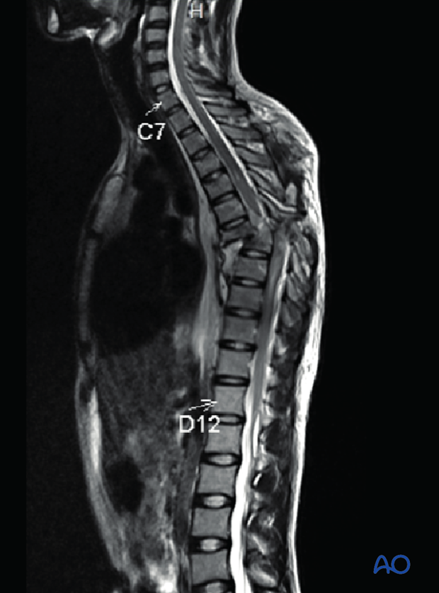 Patient Examination: Radiological evaluation (XR,CT, MRI)