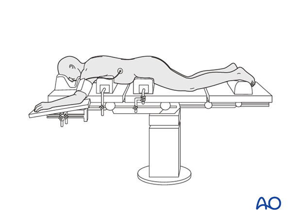 posterior midline t1 s1