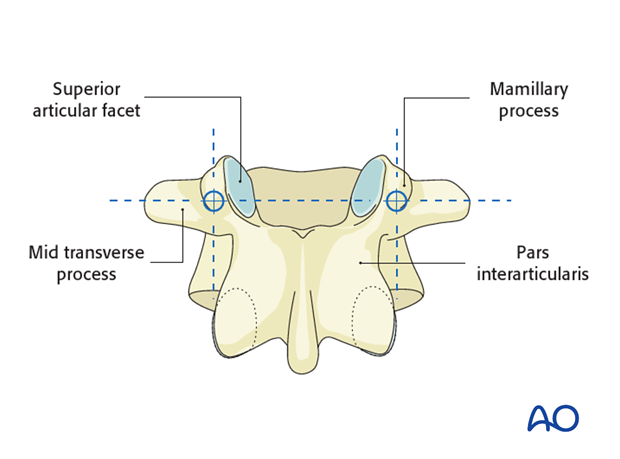 pedicle screw insertion