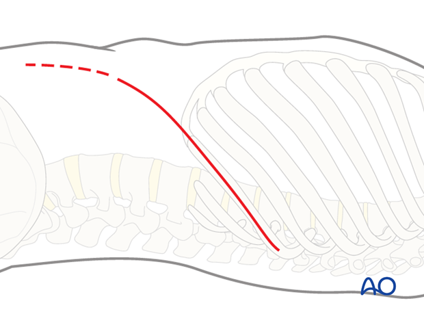 anterior approach to the lumbar spine