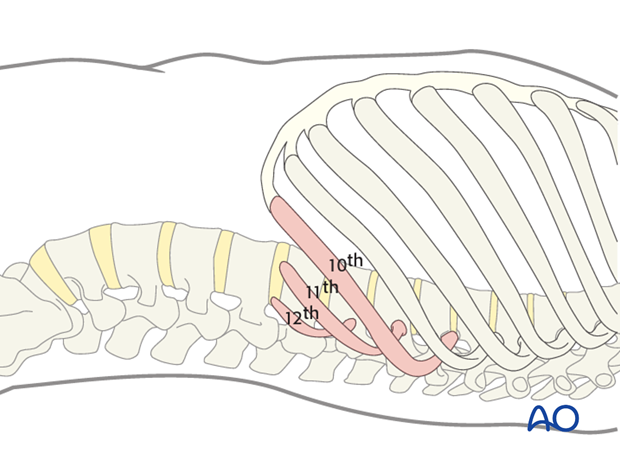 anterior approach to the lumbar spine