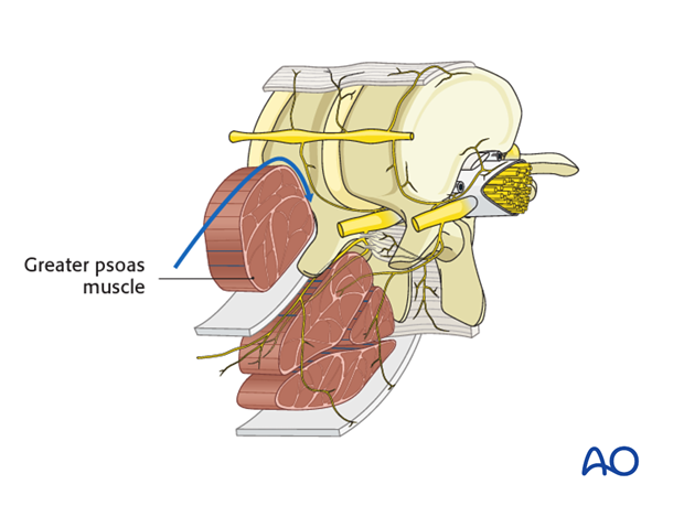 anterior approach to the lumbar spine