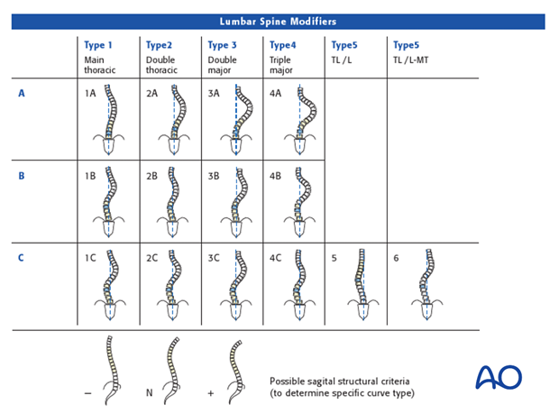 lenke classification