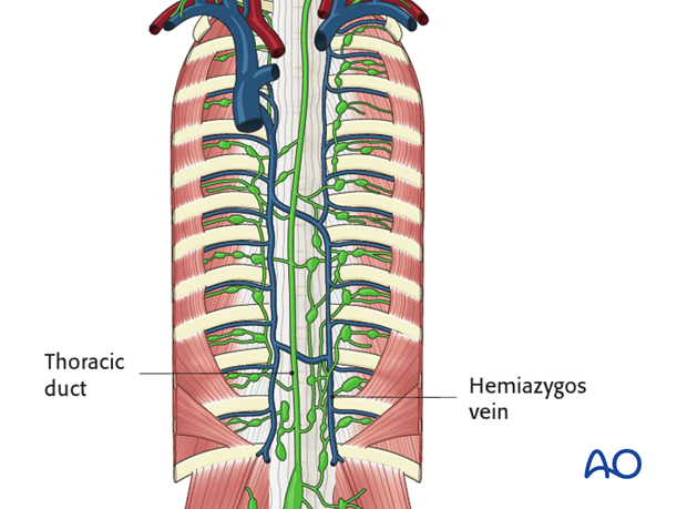 minimally invasive left side thoracic approach