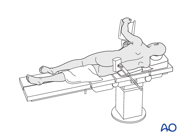 combined posterior and left side