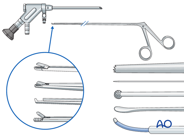 57b P410 Transforaminal endoscopic lumbar discectomy TELD