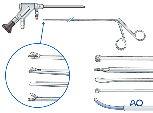 Recommended instruments for minimally invasive surgery on the lumbar spine.