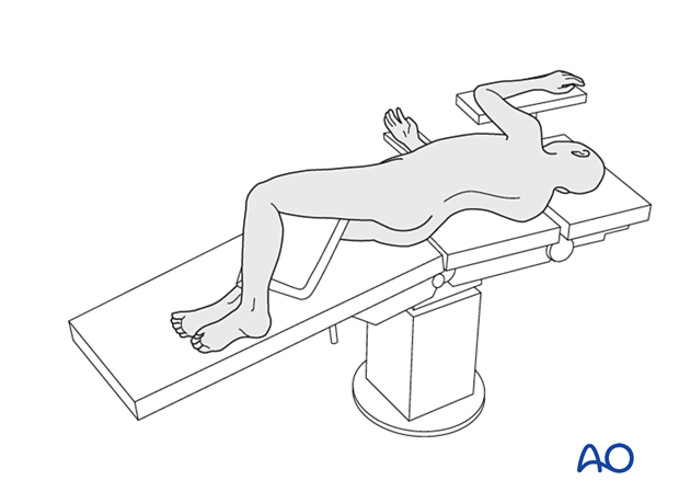 57b Pr320 Lateral decubitus position for Lateral lumbar interbody fusion LLIF