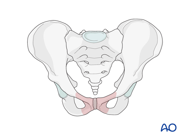 approach to the pubic symphysis