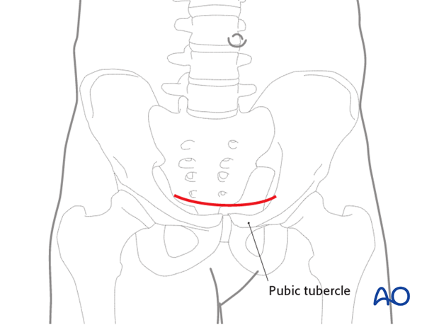 operative treatment