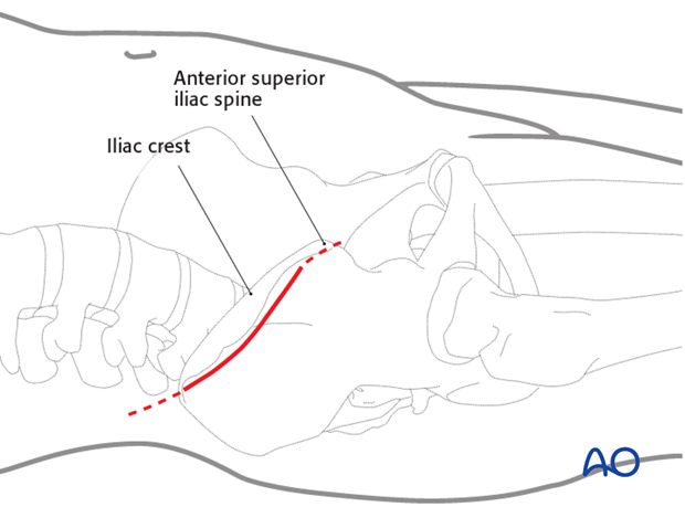 operative treatment