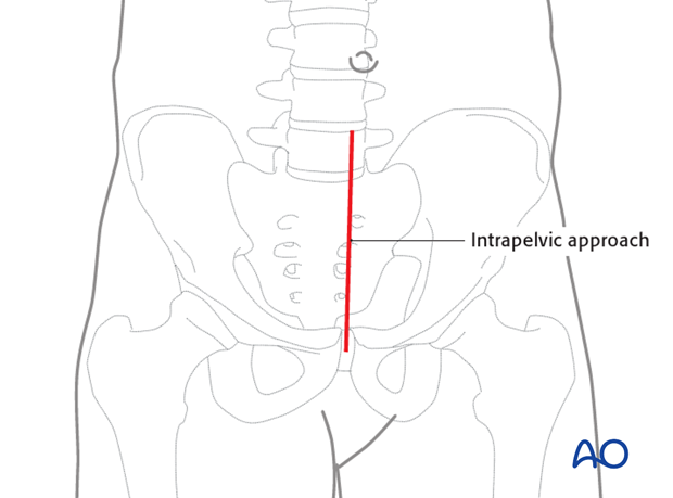 operative treatment