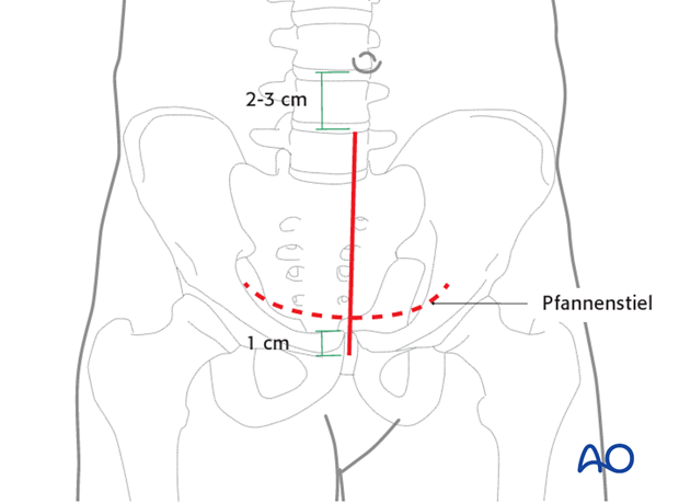 operative treatment