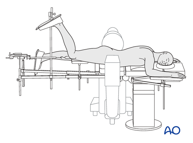 prone position