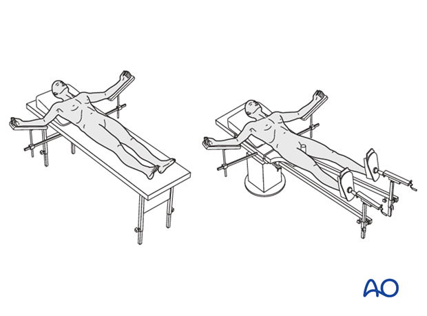 supine position