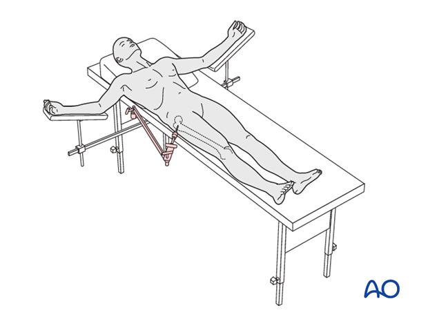 supine position