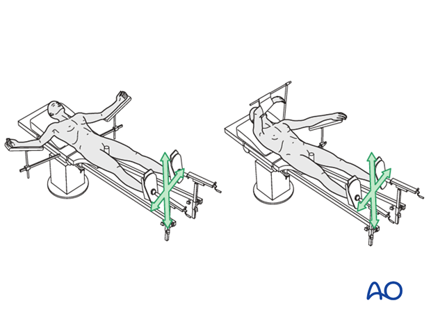 supine position