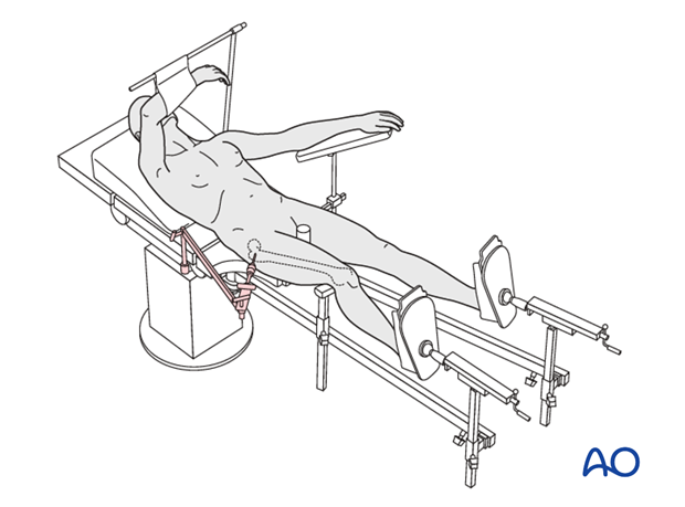 supine position