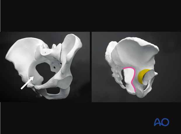 radiology of the intact acetabulum