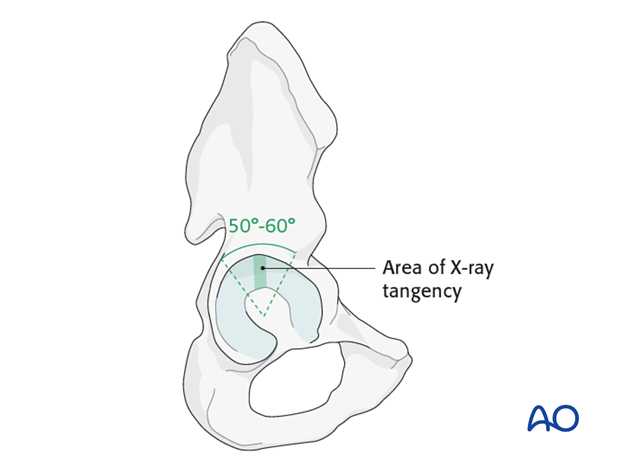 radiology of the intact acetabulum